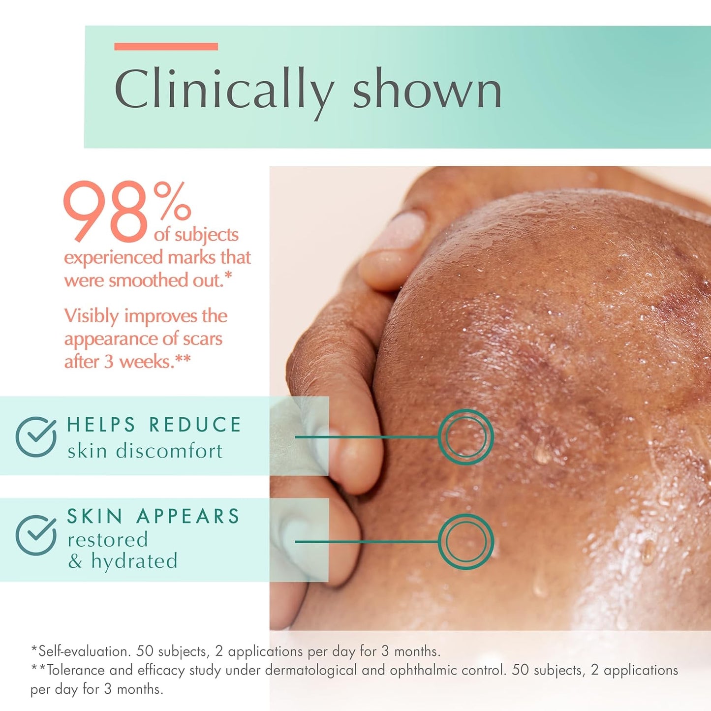 Avène Cicalfate+ Gel Cicatrizante – Gel para Cicatrices (30 ml)